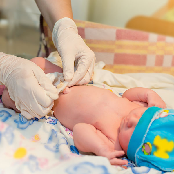 新生儿护理：关于宝宝的皮肤问题